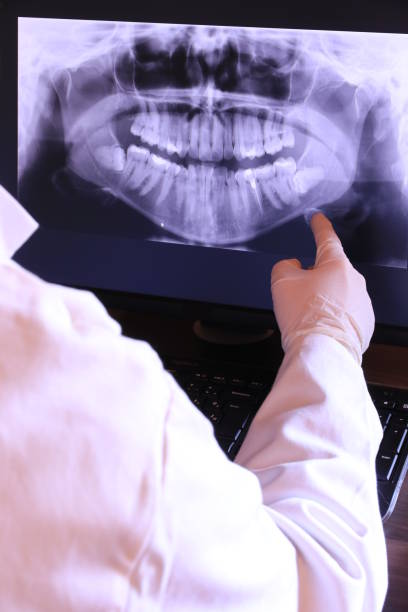 Best Chipped Tooth Repair Near Me  in Warsaw, KY