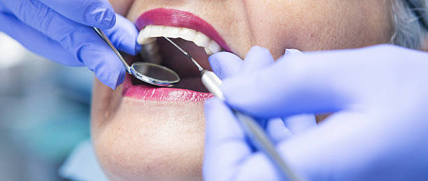 Best Chipped Tooth Repair Near Me  in Warsaw, KY